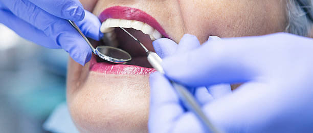 Best Knocked-Out Tooth (Avulsed Tooth) Treatment in Garnett, KS